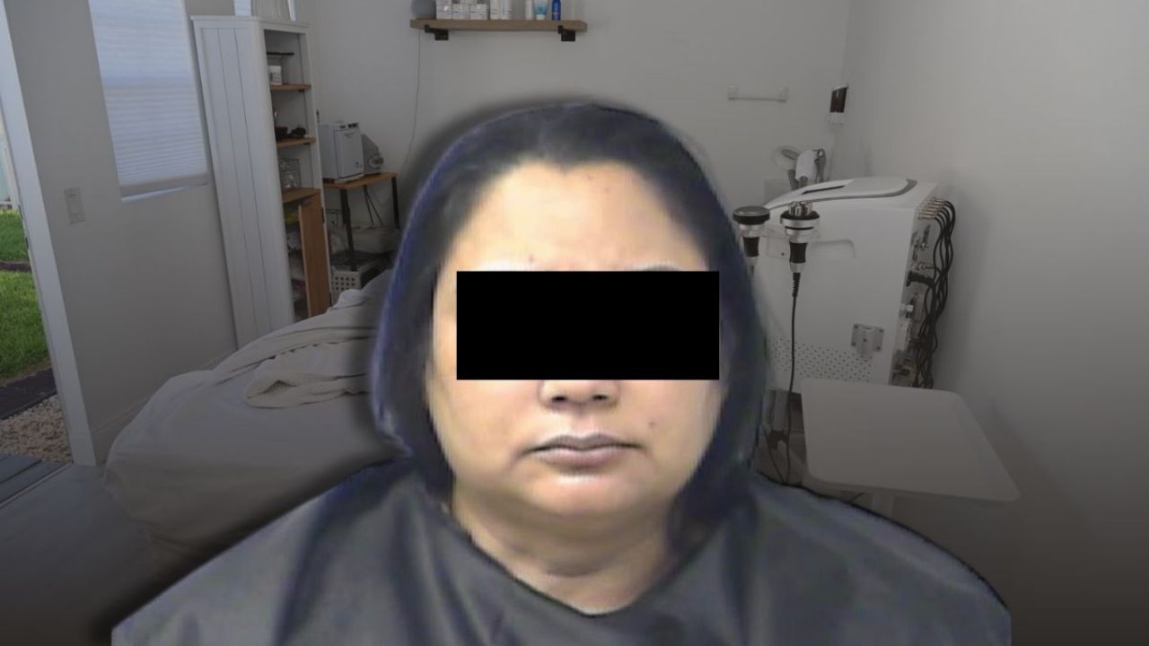 Botox ilegal deja a Mujer Con El Rostro Paralizado; Estafadora operaba en patio trasero